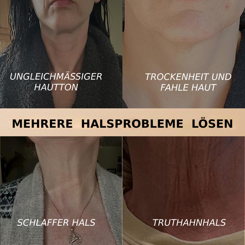 Dadine4U™ Straffende & Lifting-Halscreme – Für einen sichtbar glatteren