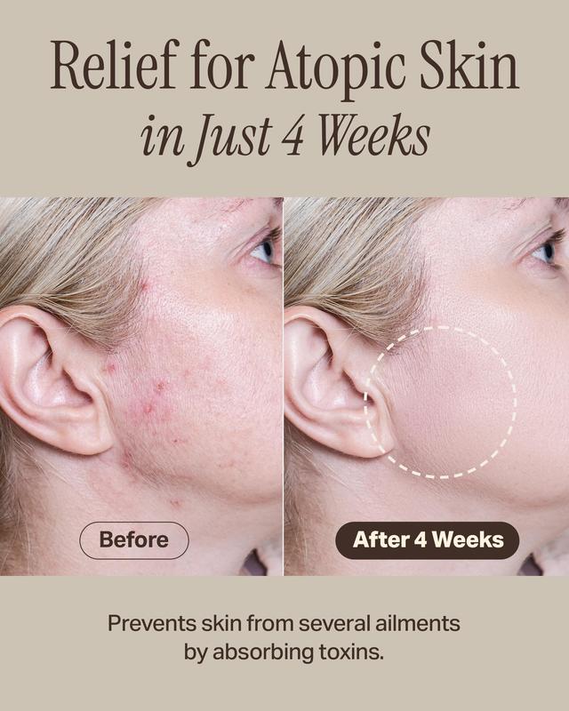 Relief Mud Mask - Cardi B Mask